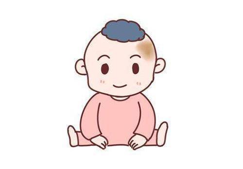 咖啡斑患者需要尽早纠正这些治疗上的误区！