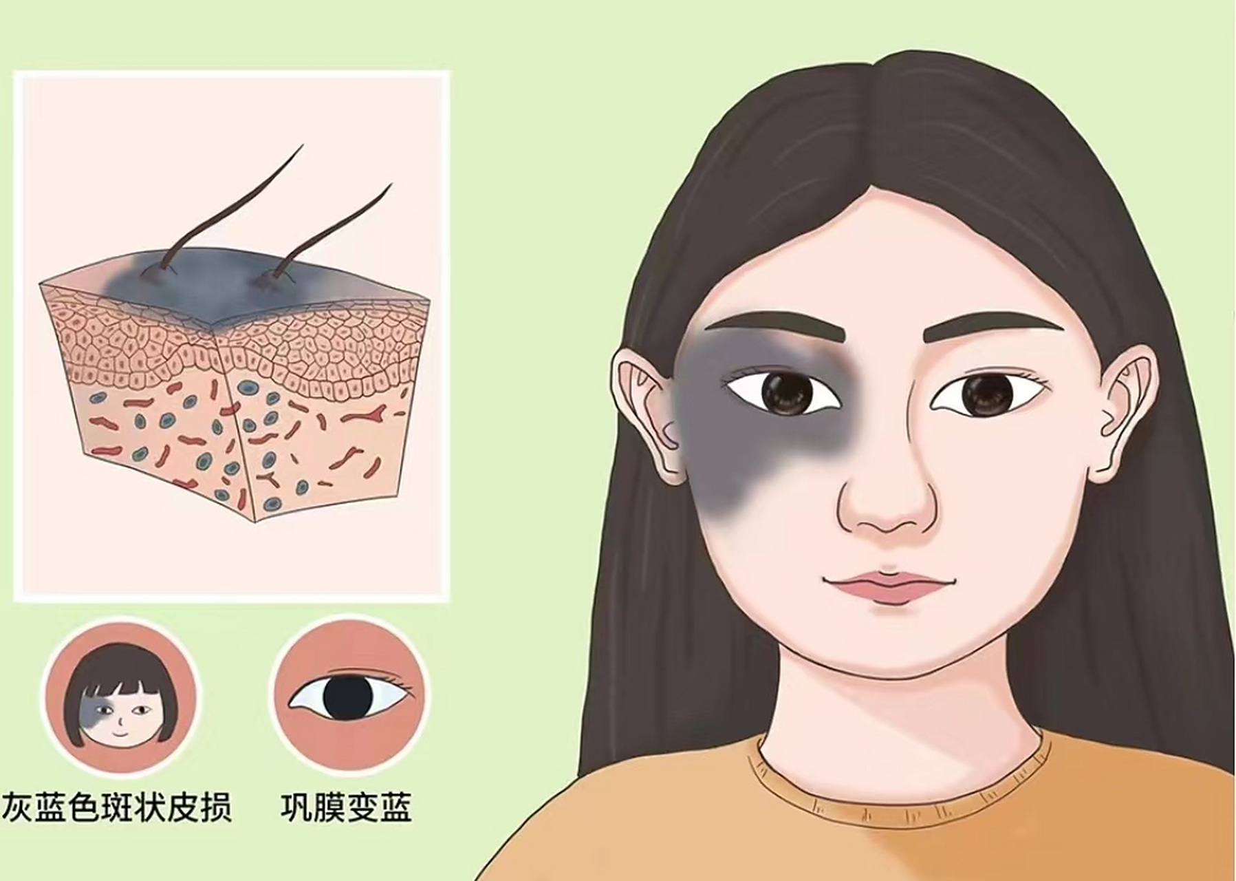 青胎记治疗费用是多少-南京治疗胎记的专科